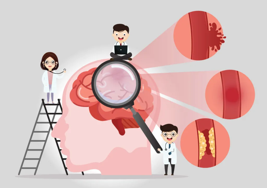 Why strokes need a bigger PR budget